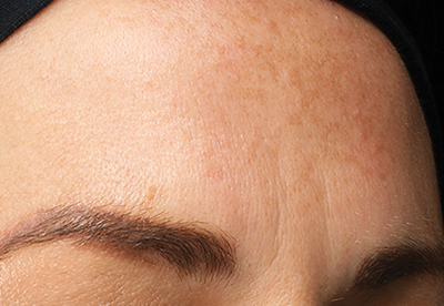 Résultats après application